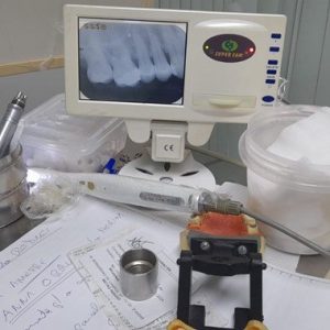 Câmera intra oral com scanner e monitor