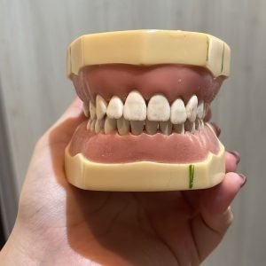 Manequim de Periodontia MOM – Usado