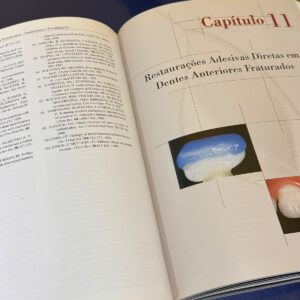 Livro de Odontologia Restauradora