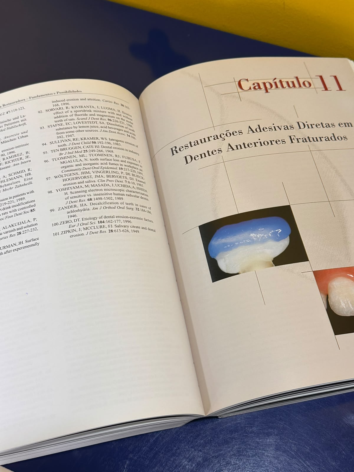 Livro de Odontologia Restauradora Livro de Odontologia Restauradora